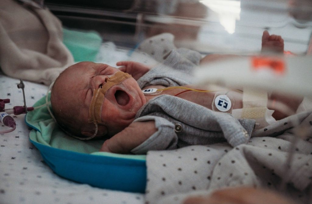 Prematuur baby Arthur