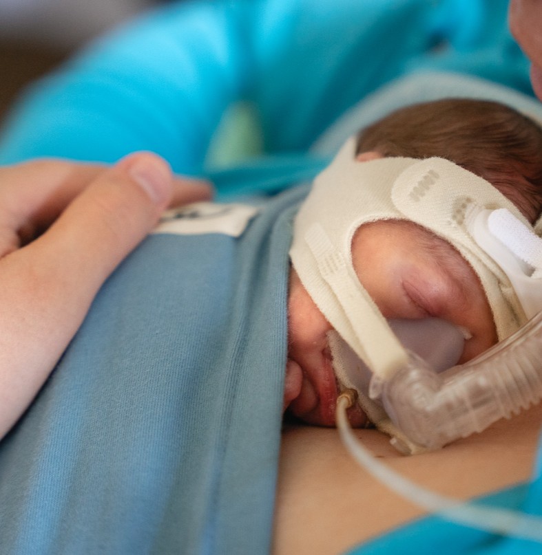 Buidelen met een prematuur baby, huid-op-huidcontact op de NICU